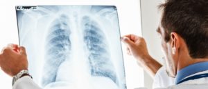 things to do to prevent lung cancer